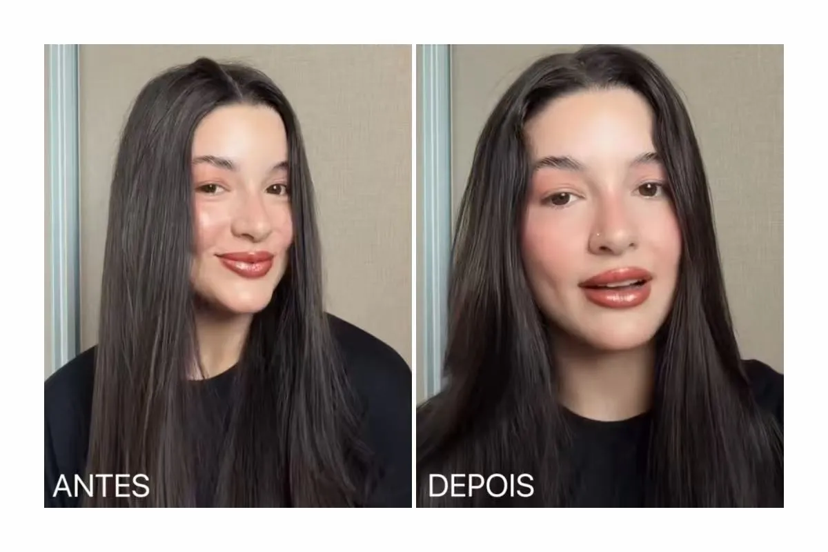 Antes e depois — resultado 9